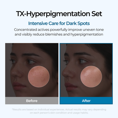 Dark Spot & Uneven Tone Peel Shot TX Duo